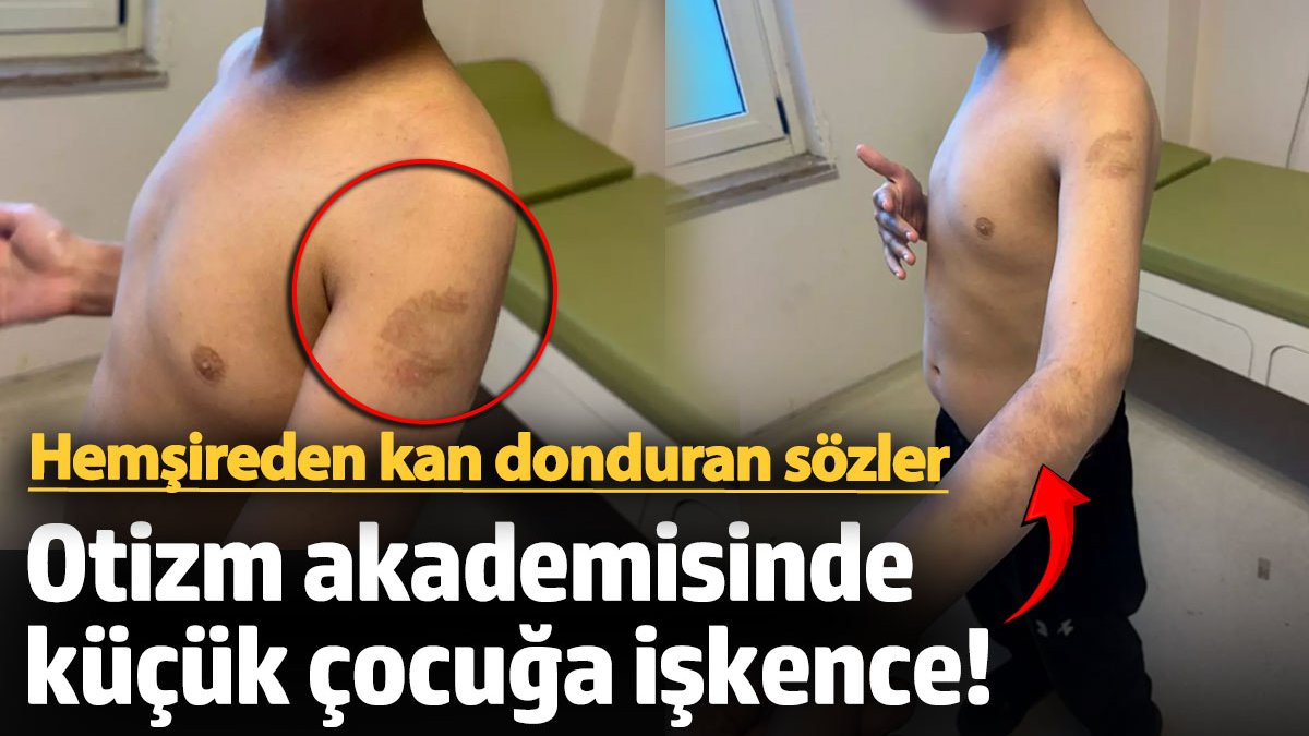 Otizm akademisinde küçük çocuğa işkence! Hemşireden kan donduran sözler