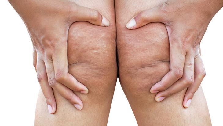 lipodem kadinlarin sessiz cigligi neden kilo veremiyorum diyenler icin cevap bNvvqPWl.jpg